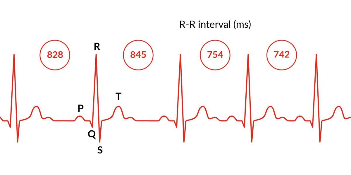 hrv-sv