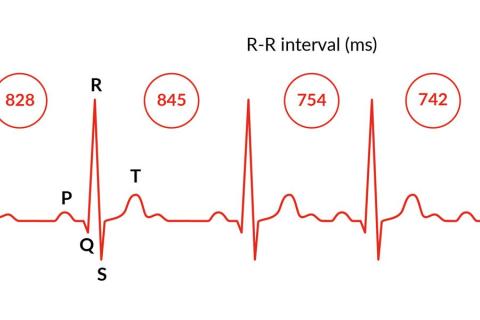 hrv-sv